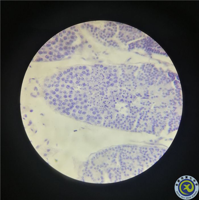 周濤 蝗蟲減數(shù)分裂.jpg 周濤 蝗蟲減數(shù)分裂.jpg