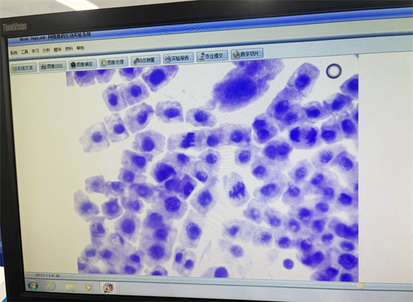 有絲分裂 分裂像.png